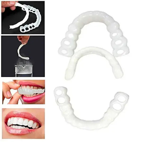 Carillas Dentales SnapOn Smile - Sonrisa perfecta desde el primer uso