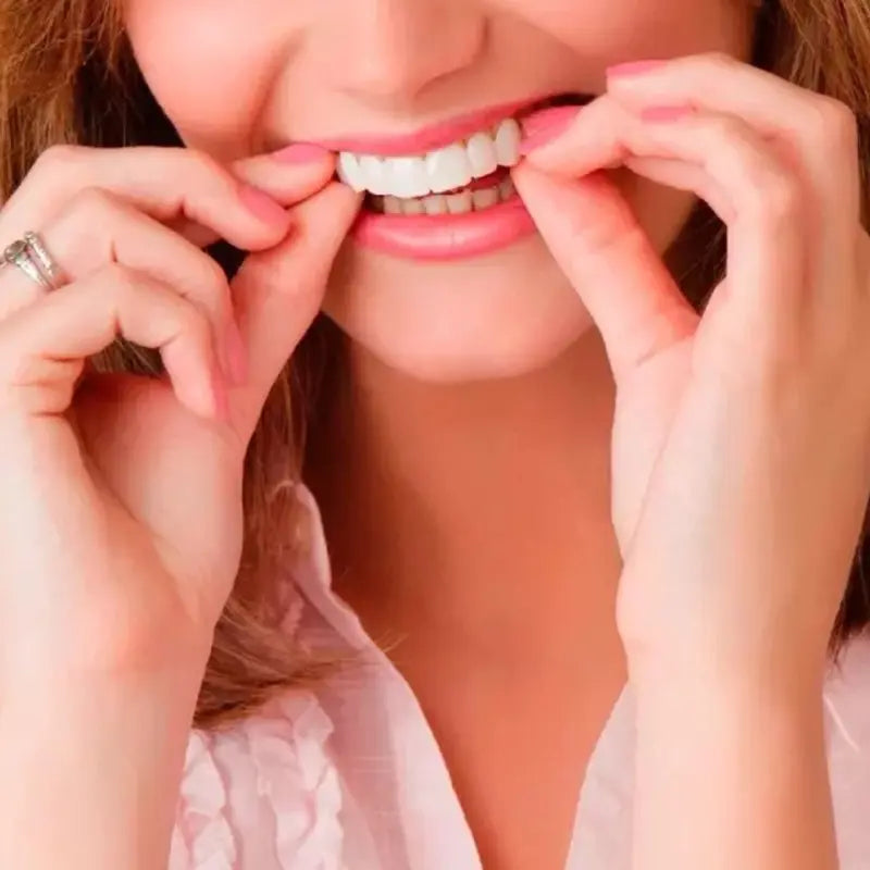 Carillas Dentales SnapOn Smile - Sonrisa perfecta desde el primer uso