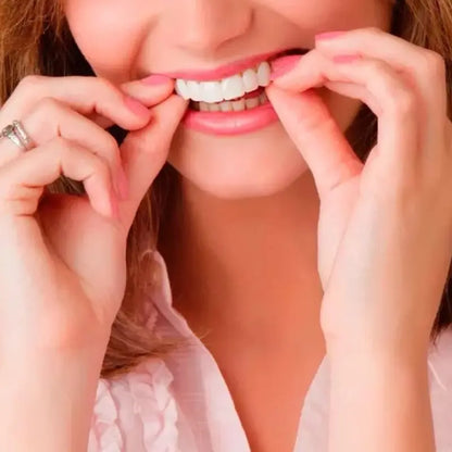 Carillas Dentales SnapOn Smile - Sonrisa perfecta desde el primer uso